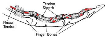 La puleggia tendinea si attacca alle ossa delle dita e mantiene insede il tendine flessore mentre si muove.