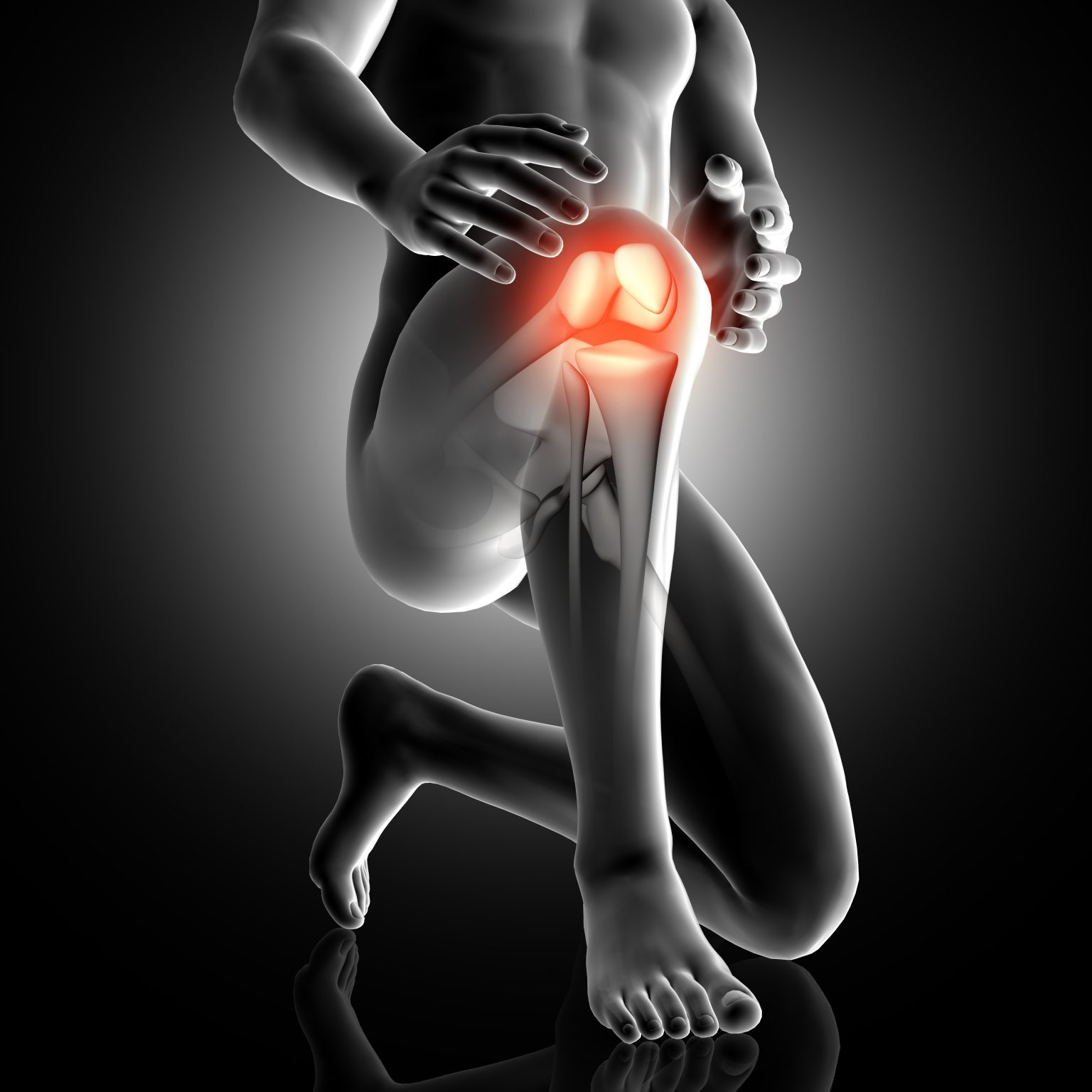 Protesi del ginocchio: quando è necessaria?